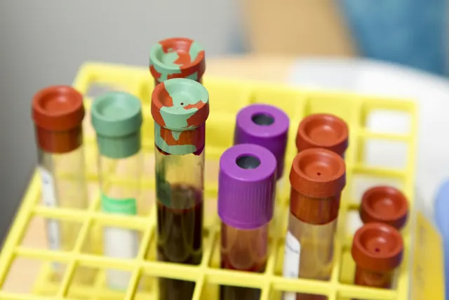 Tubos de coleta de sangue em uma estante amarela no laboratório
